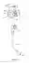 Fig. 02 - Biopsy Cap Attachment and Integrated Locking Device