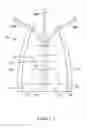 Fig. 04 - Biopsy Cap Attachment and Integrated Locking Device