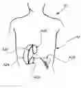 Fig. 01 - Methods and devices to decrease tissue trauma during surgery