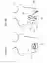 Fig. 33 - Methods and devices to decrease tissue trauma during surgery