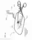 Fig. 46 - Methods and devices to decrease tissue trauma during surgery