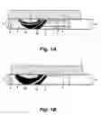 Fig. 02 - Hemostatic guiding catheter
