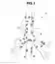 Fig. 02 - TREATMENT INSTRUMENT FOR ENDOSCOPE AND LYMPH NODE REMOVING METHOD