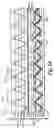 Fig. 09 - Temperature compensated strain sensing catheter