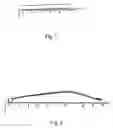 Fig. 02 - Implant for long bones and treatment method