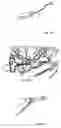 Fig. 04 - Implant for long bones and treatment method
