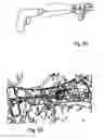 Fig. 06 - Implant for long bones and treatment method