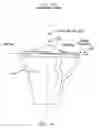 Fig. 06 - Method and apparatus for performing an open wedge, high tibial osteotomy