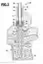 Fig. 03 - IMPLANT AND IMPLANTATION SYSTEM