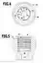Fig. 05 - IMPLANT AND IMPLANTATION SYSTEM