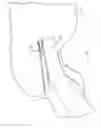 Fig. 06 - Drill guide and method for placing a fixation device hole