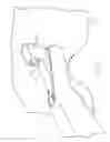 Fig. 07 - Drill guide and method for placing a fixation device hole