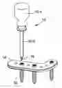Fig. 01 - PERCUTANEOUS SCREW EXTRACTOR