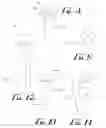 Fig. 06 - Enhanced products and processes for removing cavity tissue