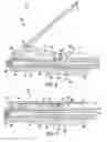 Fig. 04 - Apparatus and system for orthopedic fastener insertion and extraction