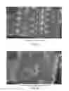 Fig. 04 - Portable moist heat system