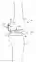 Fig. 01 - Dynamic knee balancer with pressure sensing