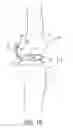 Fig. 03 - Dynamic knee balancer with pressure sensing
