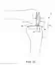 Fig. 04 - Dynamic knee balancer with pressure sensing