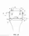 Fig. 06 - Dynamic knee balancer with pressure sensing