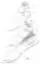 Fig. 05 - Foot prosthesis with resilient multi-axial ankle