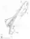Fig. 14 - Foot prosthesis with resilient multi-axial ankle