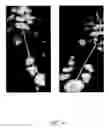 Fig. 28 - Foot prosthesis with resilient multi-axial ankle