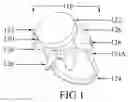 Fig. 02 - Universal ligature suitable for many instruments