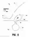 Fig. 07 - Microjet creation and control of shock waves