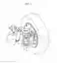 Fig. 02 - Bump stopper for suspension system