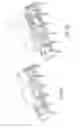 Fig. 09 - Active image area positioning with adjustable patient bench permitting chair-shaped patient transport into and out of an open MRI apparatus system