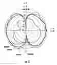 Fig. 04 - Broadband terminated discone antenna and associated methods