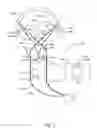 Fig. 02 - PROBING DEVICE AND A SYSTEM FOR OBTAINING GEOMETRICAL DATA RELATED TO A CAVITY