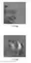 Fig. 09 - Gene injection apparatus and gene injection method