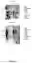 Fig. 42 - Nucleotide and amino acid sequences relating to respiratory diseases and obesity