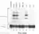 Fig. 93 - Methods to identify compounds useful for the treatment of proliferative and differentiative disorders