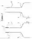 Fig. 03 - Device for Preventing Fluid Drip From a Bottle
