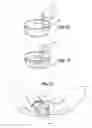 Fig. 06 - Total knee joint mold and methods