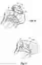 Fig. 07 - Total knee joint mold and methods