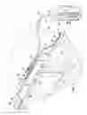 Fig. 03 - Reduced-pressure, compression systems and apparatuses for use on a curved body part
