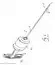 Fig. 02 - Vein stripping device