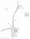 Fig. 03 - Vein stripping device