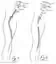 Fig. 07 - Vein stripping device