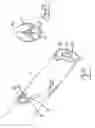 Fig. 14 - Vein stripping device