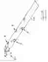 Fig. 19 - Vein stripping device
