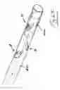 Fig. 44 - Vein stripping device