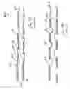 Fig. 48 - Vein stripping device