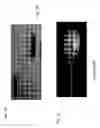 Fig. 02 - CRYONEEDLE AND CRYOTHERAPHY SYSTEM