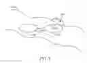 Fig. 03 - Device, system and method for in-vivo cauterization