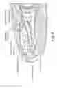 Fig. 09 - Near infrared microbial elimination laser systems (NIMEL)
